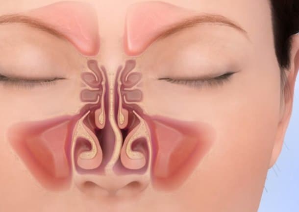 Septoplasty Septoplasty Austin, TX