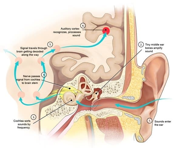 Types of Hearing Loss Hearing Loss Austin, TX