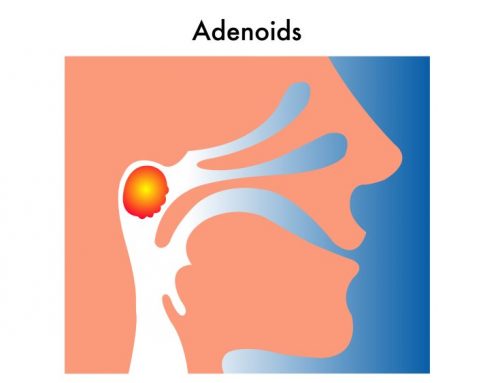 Adenoid Size Assessment