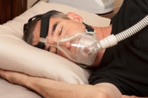 Sleep Apnea Surgery